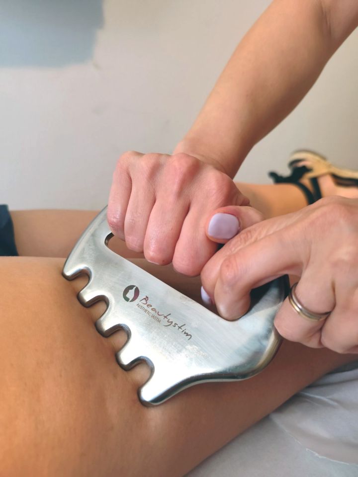 κυτταρίτιδα